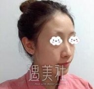 贾大辉做鼻子怎么样？有案例可以看吗？ width=