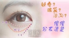 泪沟有什么办法可以去掉？如何有祛泪沟？ width=
