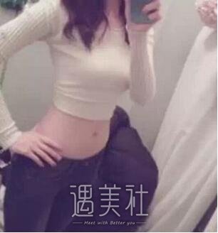 杭州静港程卫民吸脂果好不好?看看我的真实案例吧!