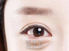 手术去眼袋价格是多少?各个方式收费不同吧? width=
