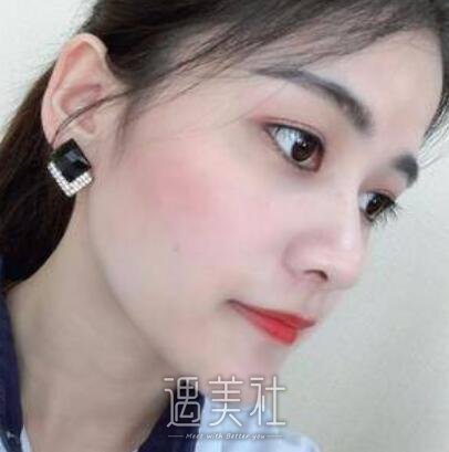 沈阳,陆军总院,光子嫩肤