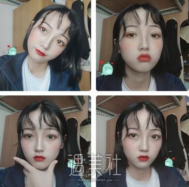 北京,李沁奕,隆鼻