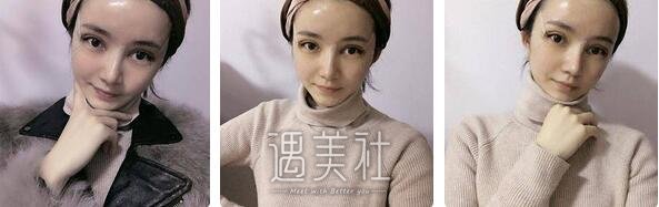 刘菲,九院