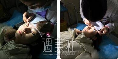 刘菲,九院