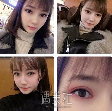 刘菲,九院