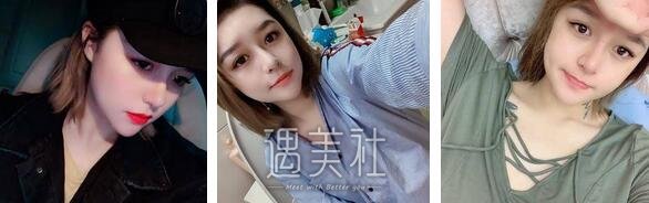 上海,缩小鼻翼