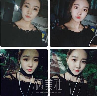 南京,美贝尔,黄名斗,隆鼻