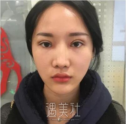 江苏省中医院整形双眼皮怎么样?有相关案例吗?