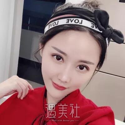 江苏省中医院整形双眼皮怎么样?有相关案例吗?