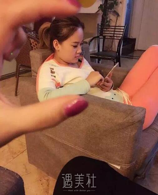 南京天熙隆鼻案例展示，丑与美就在一线之间!