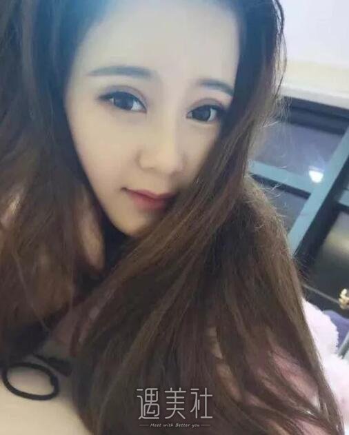 南京天熙隆鼻案例展示，丑与美就在一线之间!