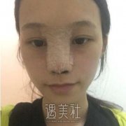 徐晓斐做鼻子怎么样?有案例吗? width=
