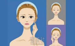 北京清华长庚医院光子嫩肤价格大概多少？ width=