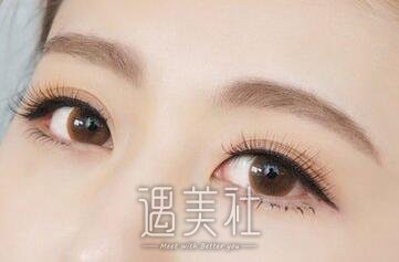 重庆,开眼角