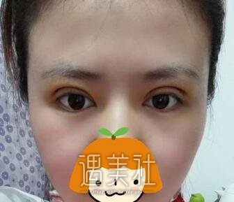 刘育凤