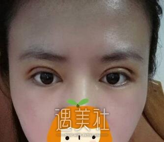 刘育凤