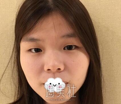 刘育凤