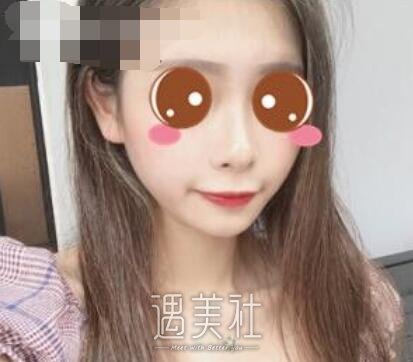 上海,九院,王健,隆鼻