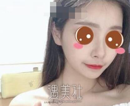 上海,九院,王健,隆鼻