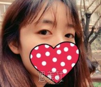 孙强双眼皮案例:别人说我越长越年轻了~ width=