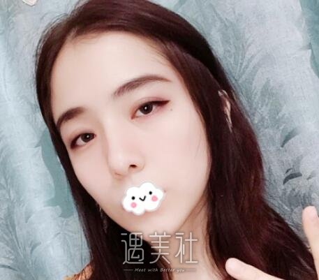 唐振利,隆鼻