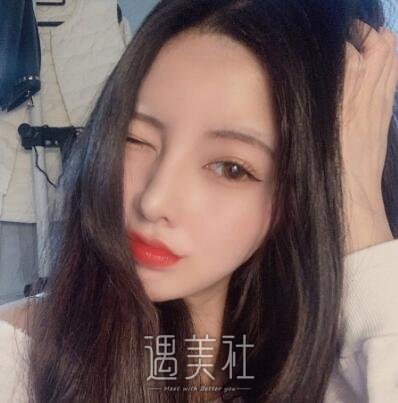 北京美莱欧阳春鼻修复案例|拥有了人见人爱的鼻子!