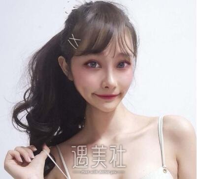 郑延清做颧骨案例分享|心情都变好了不少!