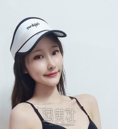 郑延清做颧骨案例分享|心情都变好了不少!