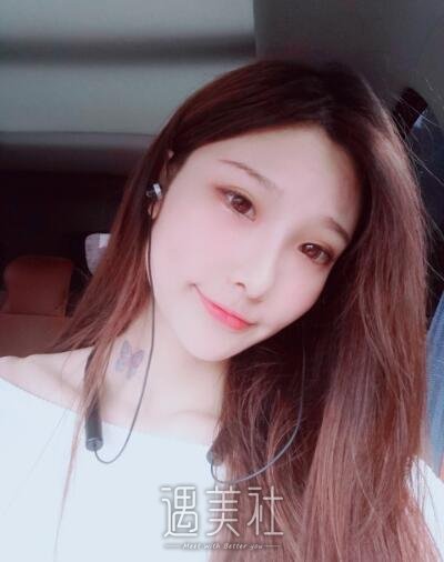 郑延清做颧骨案例分享|心情都变好了不少!