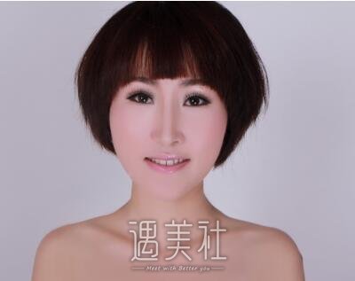 北京润美宋丽秋祛斑案例|事业爱情双丰收!