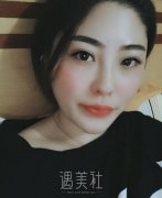 中日友好胡晓根腋臭去除案例|终于有人接近我了! width=
