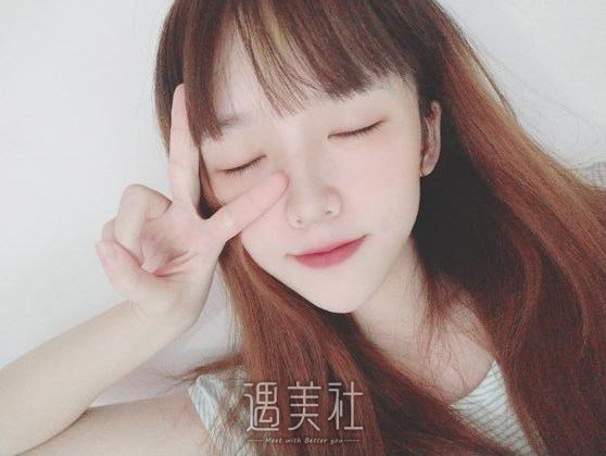 北京凯润婷宋长绪玻尿酸隆鼻案例|简单便捷见快!