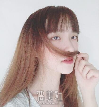 北京凯润婷宋长绪玻尿酸隆鼻案例|简单便捷见快!