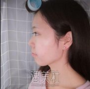 上海九院韦敏磨骨日志有吗 width=
