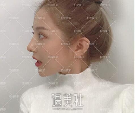 李劲良