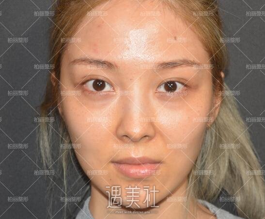 李劲良