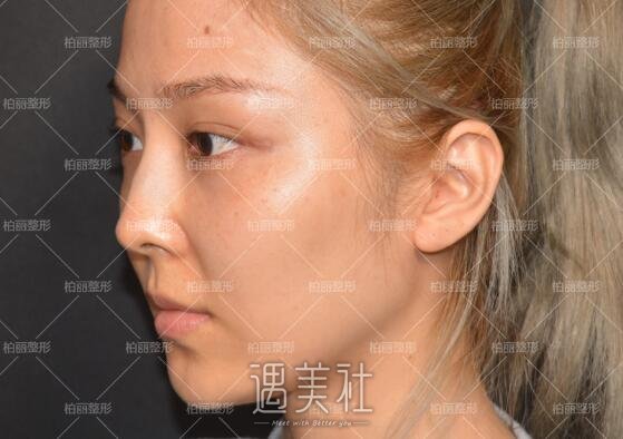 李劲良