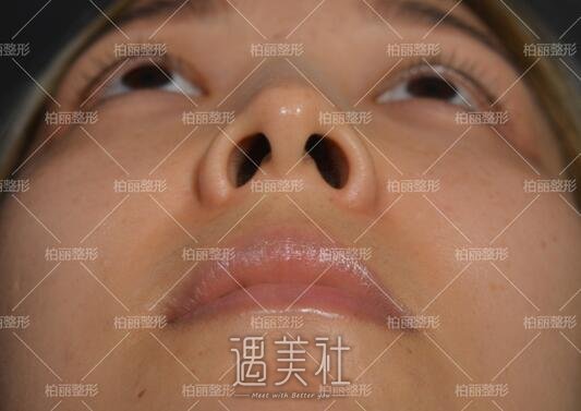 李劲良