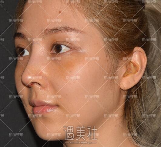 李劲良