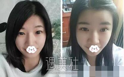 南方医院整形科,冯传波
