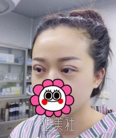 荆州,名韩,做双眼皮