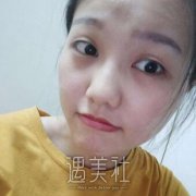 韩美整形双眼皮怎么样?这个技术你看了才知道~ width=
