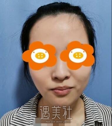 朝阳二院美容科