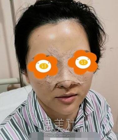 朝阳二院美容科