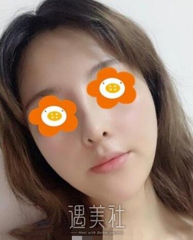 朝阳二院美容科
