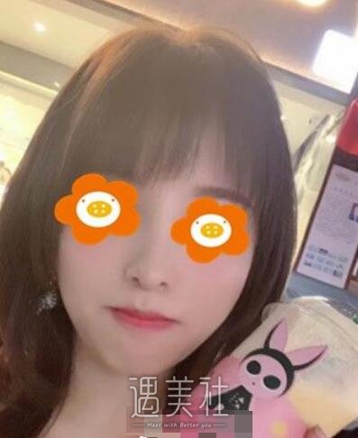 朝阳二院美容科