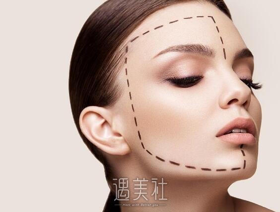 除皱