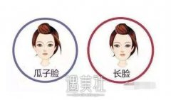 瓜子脸手术方式有哪些 哪个好点? width=