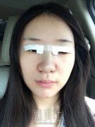 南昌鹏爱王朝根医生介绍 有案例图吗? width=