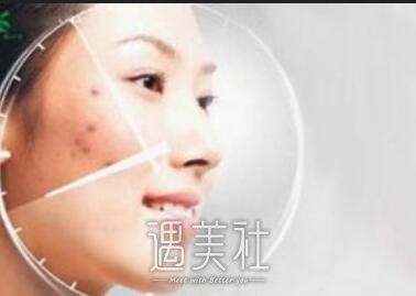 北京协和美容科,祛斑